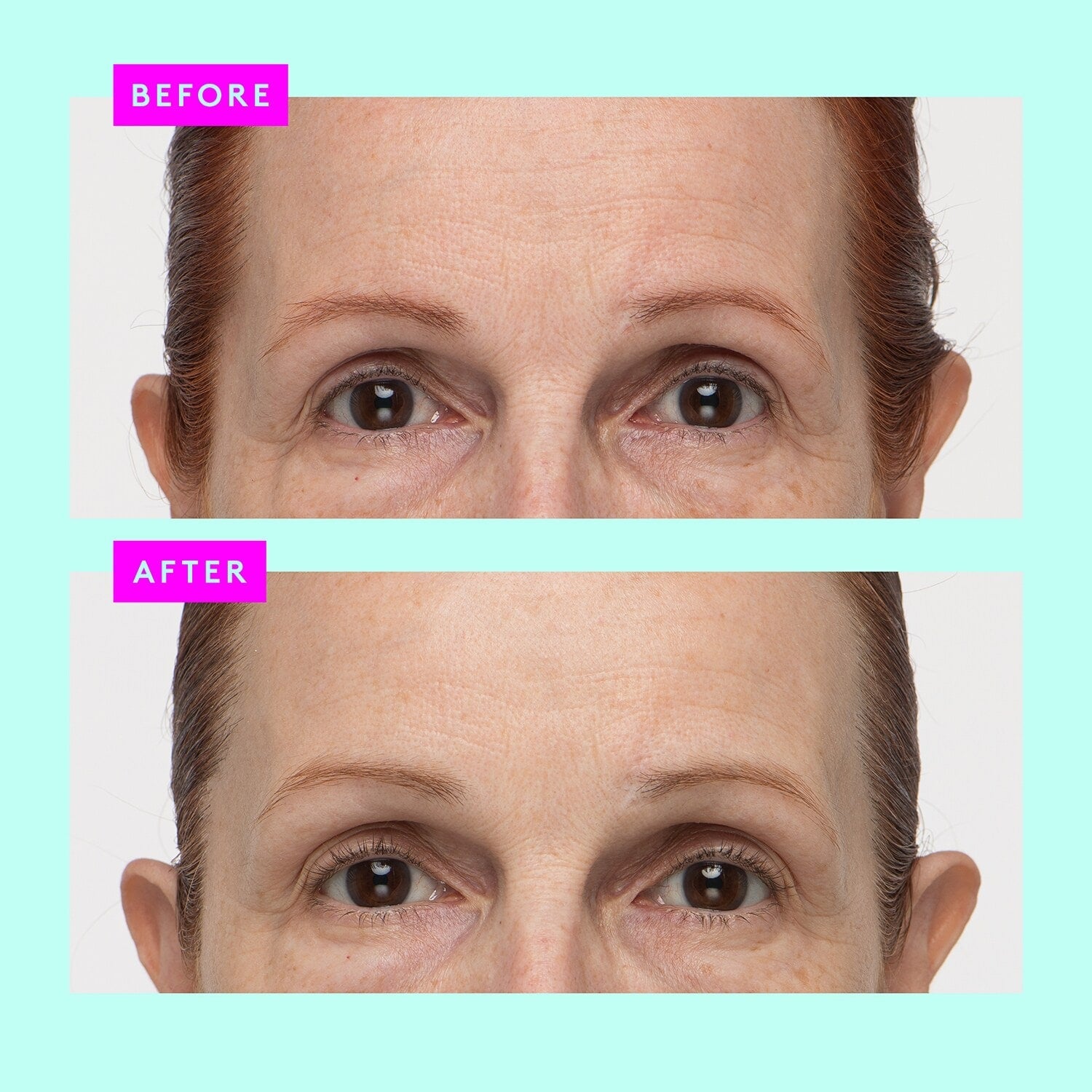 Protini™ Polypeptide Cream