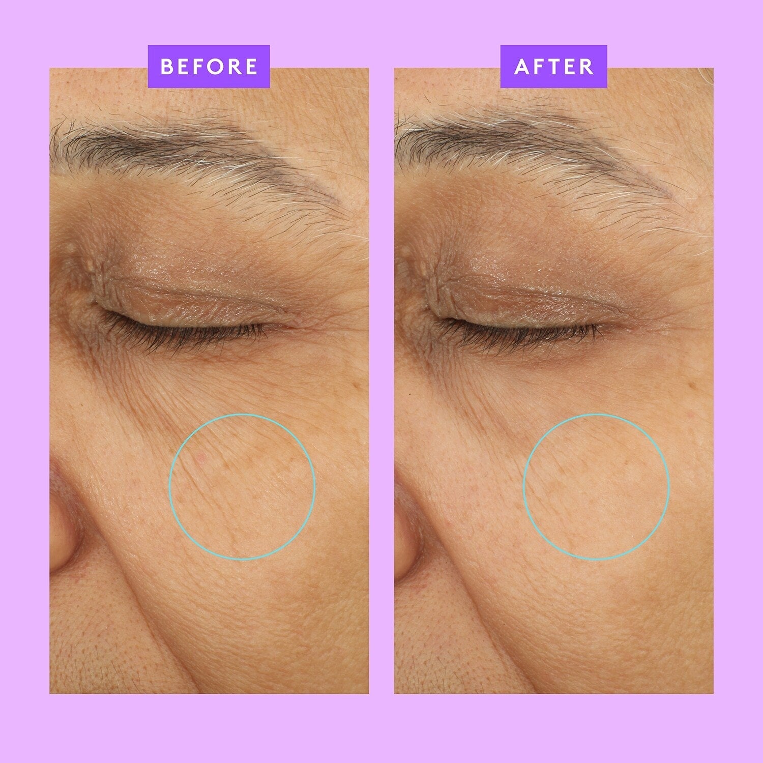 Ceramighty™ AF Eye Balm - Anti-Wrinkle Eye Cream