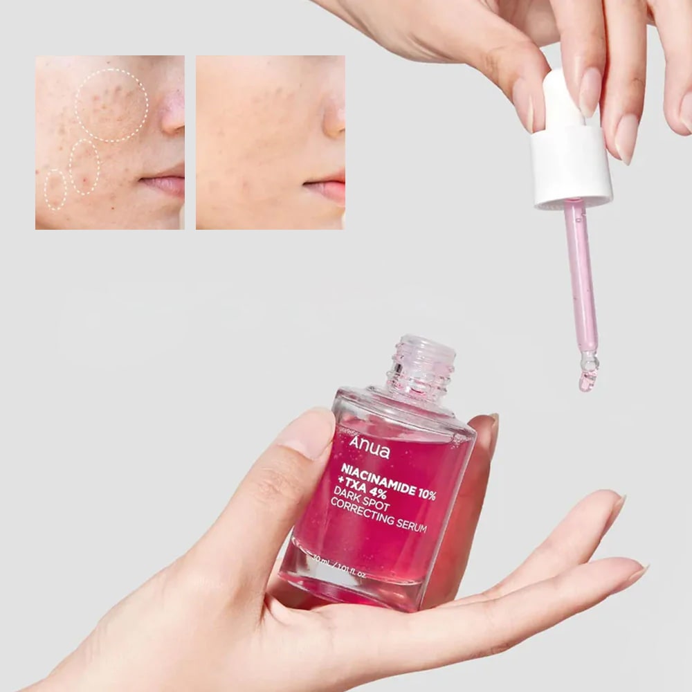 Anua Niacinamide 10% + TXA 4% Dark Spot Correcting Serum